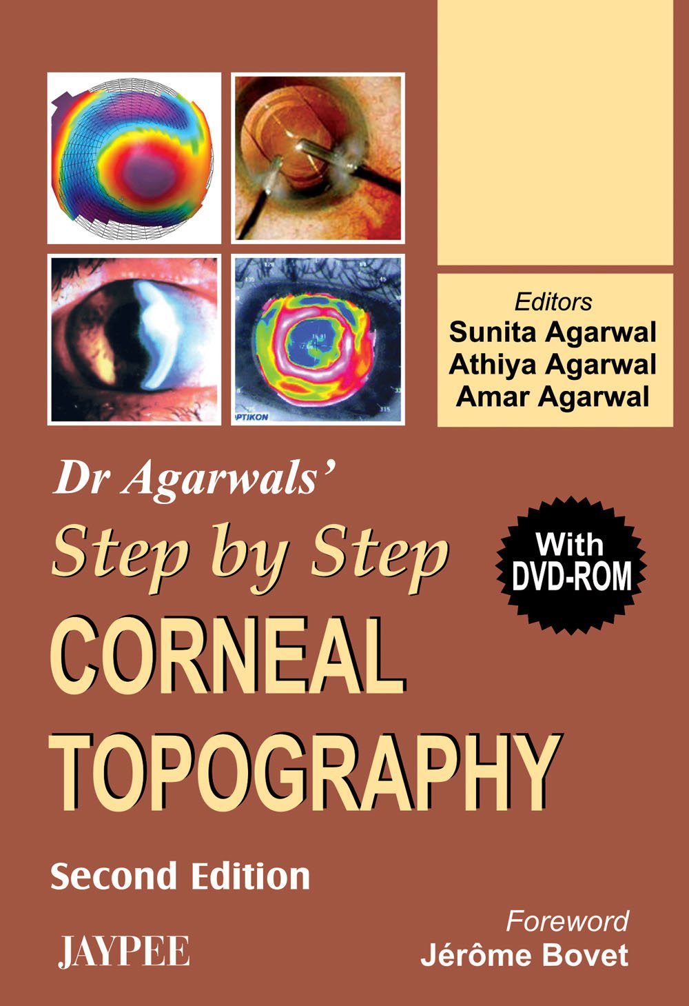 dragarwals-step-by-step-corneal-topography-with-dvd-rom