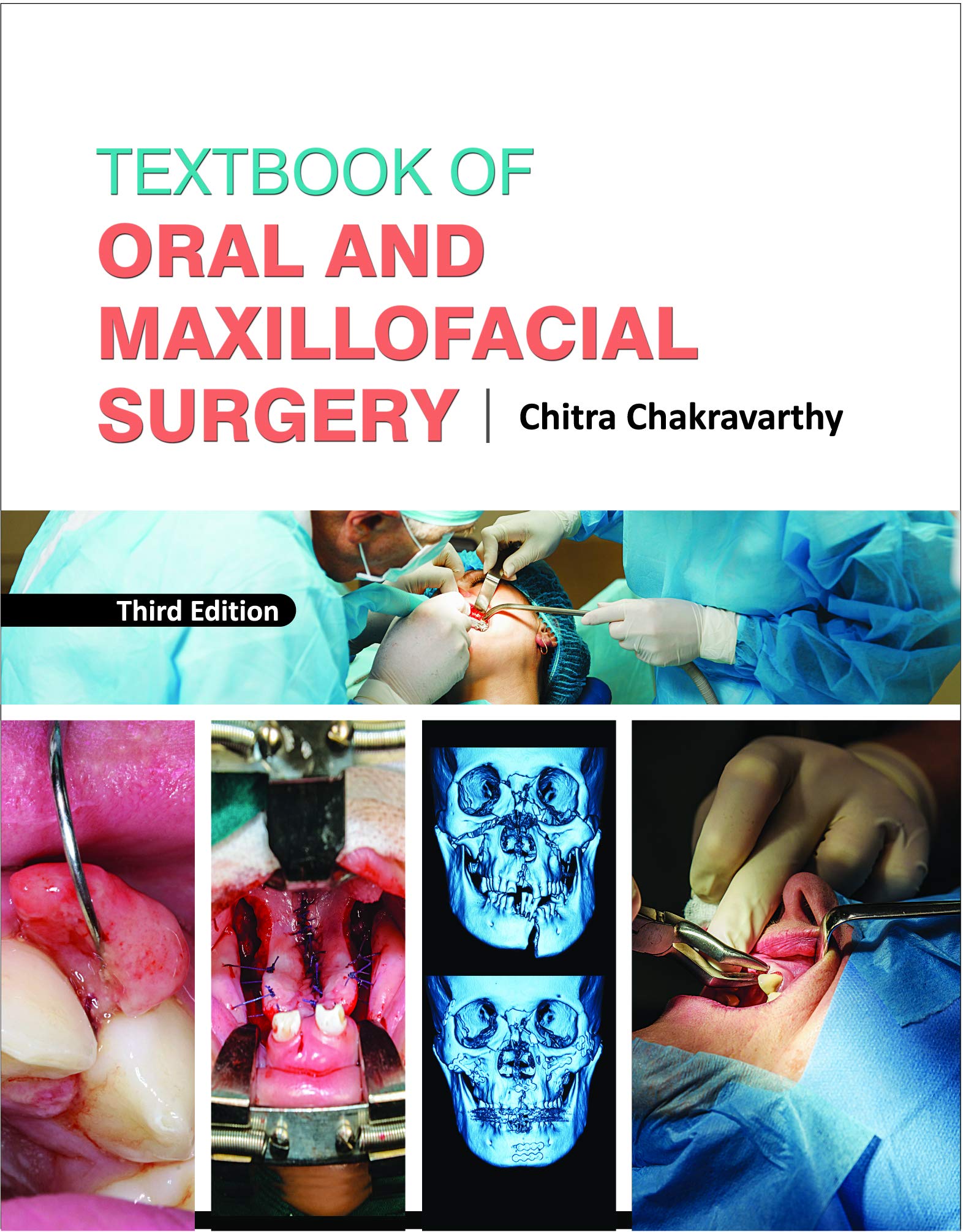 textbook-of-oral-and-maxillofacial-surgery-third-edition