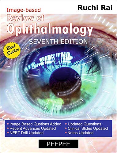 review-of-ophthalmology-7e