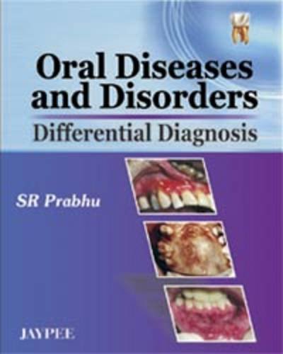 oral-diseases-and-disorders-differential-diagnosis