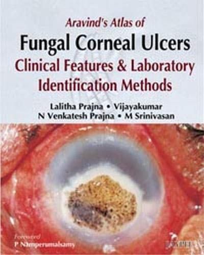 aravinds-atlas-of-fungal-corneal-ulcers-clinical-features-labidentification-methods