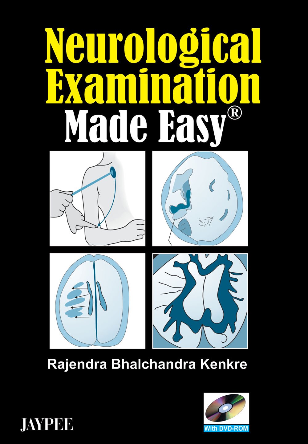 neurological-examination-made-easy-with-dvd-rom