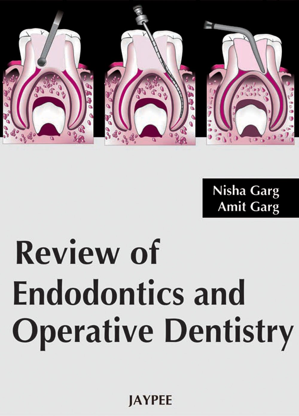 review-of-endodontics-and-operative-dentistry