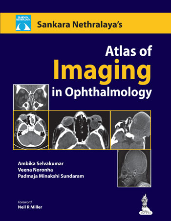sankara-nethralaya-atlas-of-imaging-in-ophthalmology
