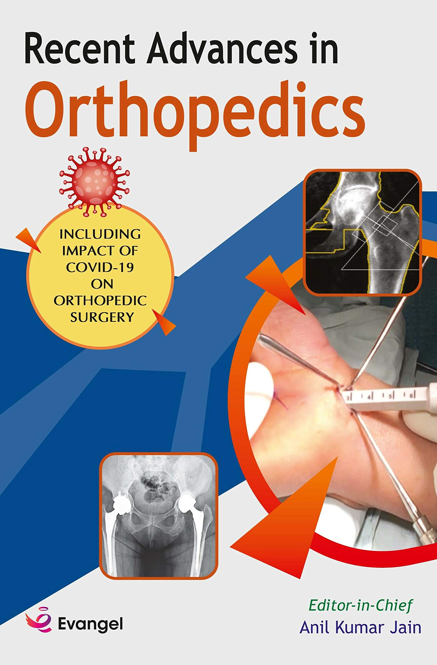 recent-advances-in-orthopedics