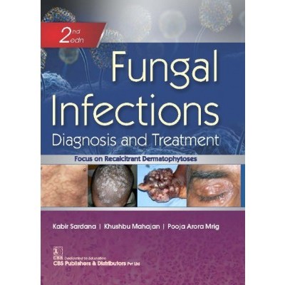 fungal-infections-2e-diagnosis-and-treatment