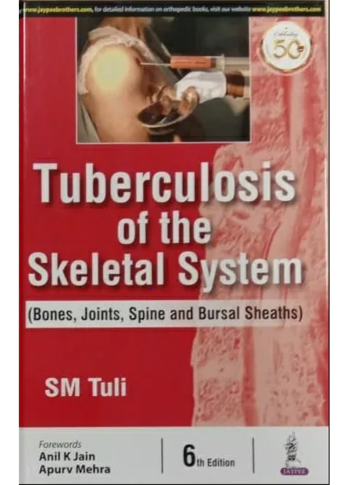 tuberculosis-of-the-skeletal-system-6th
