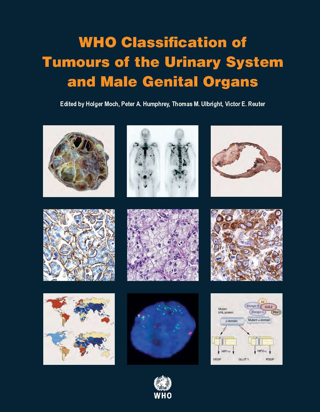 who-classification-of-tumours-of-the-urinary-system-and-male-genital-organs-world-health-organization-who-classification-of-tumours