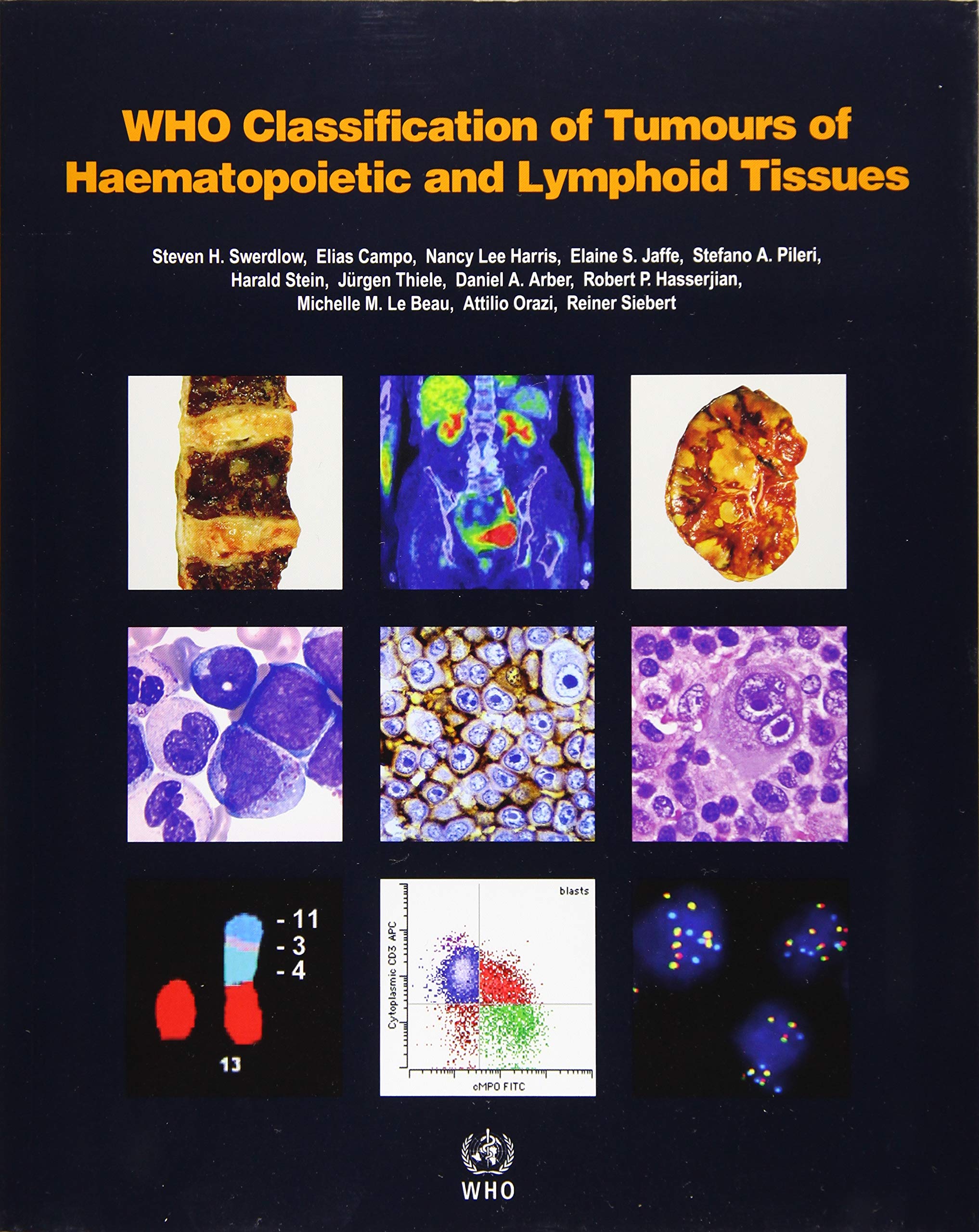 who-classification-of-tumours-of-haematopoietic-and-lymphoid-tissues-vol-2-world-health-organization-who-classification-of-tumours