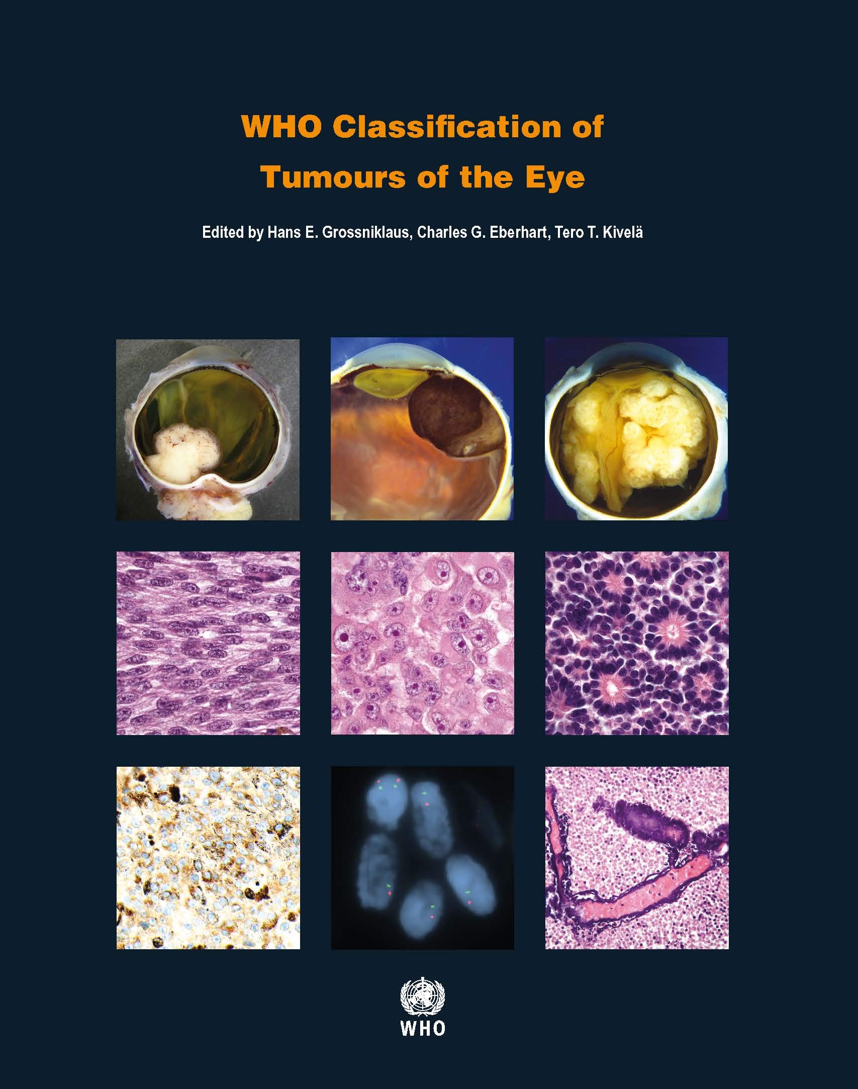who-classification-of-tumours-of-eye