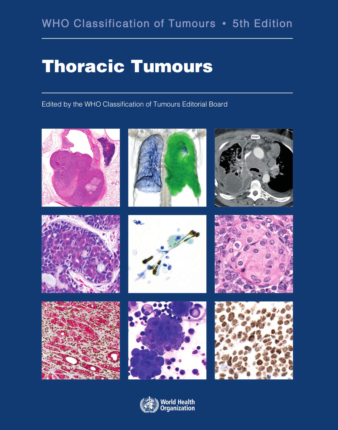 who-classification-of-tumours-5th-edition-volume-5-thoracic-tumours