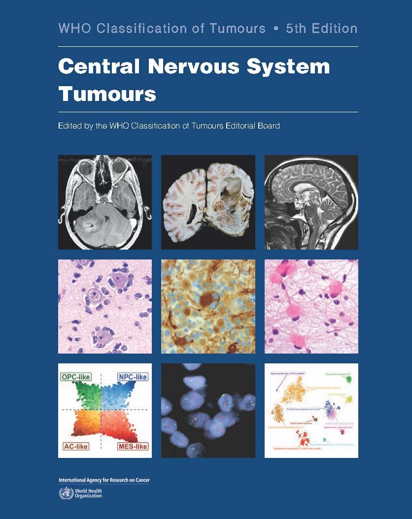 who-classification-of-tumours-of-the-central-nervous-system-6-world-health-organization-classification-of-tumours