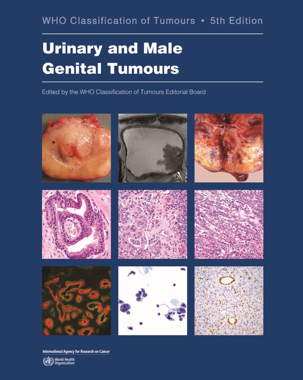urinary-and-male-genital-tumours-8-who-classification-of-tumours