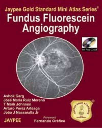 fundus-fluorescein-angiography-jaypee-gold-standard-mini-atlas-series-with-photo-cd-rom