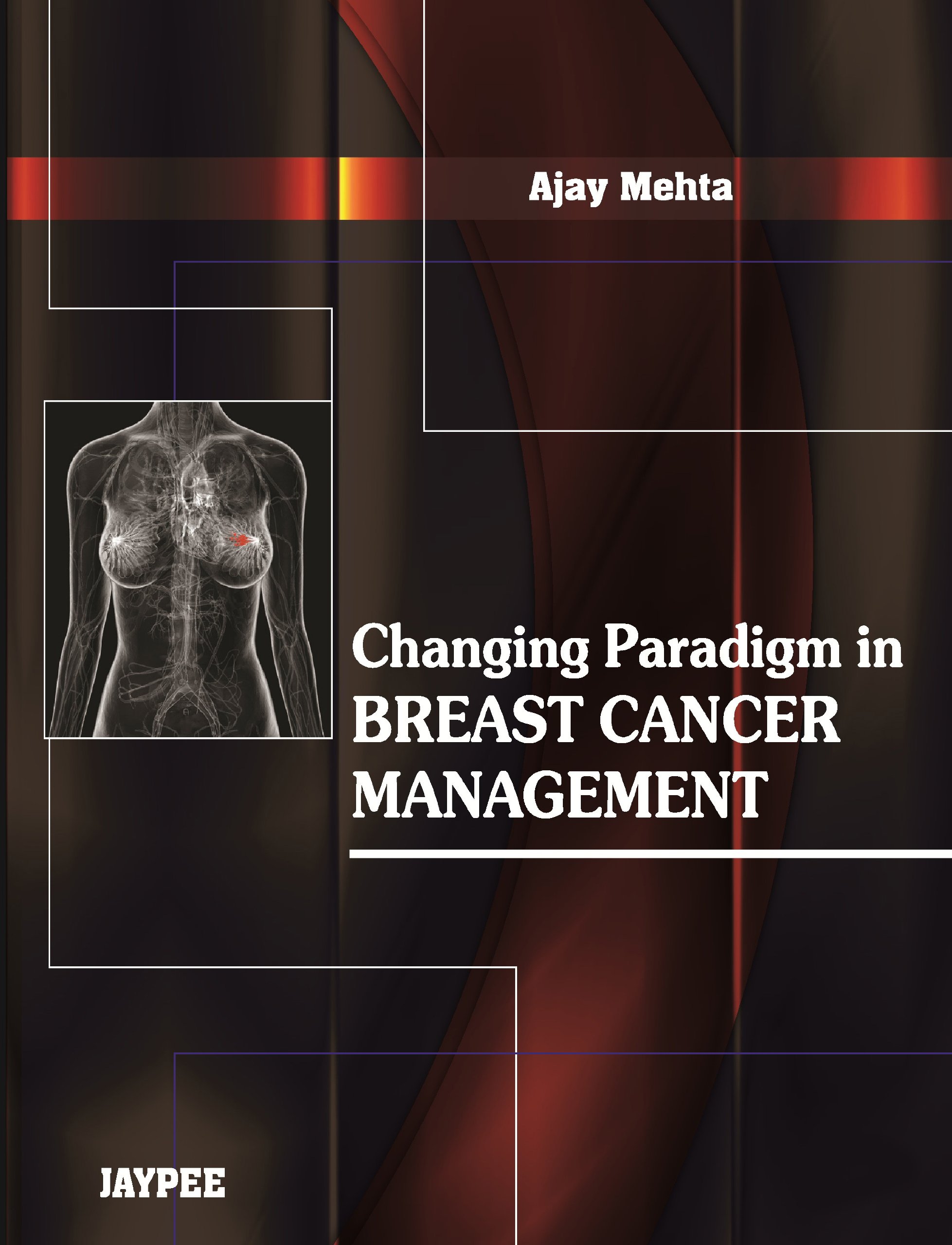 changing-paradigm-in-breast-cancer-management