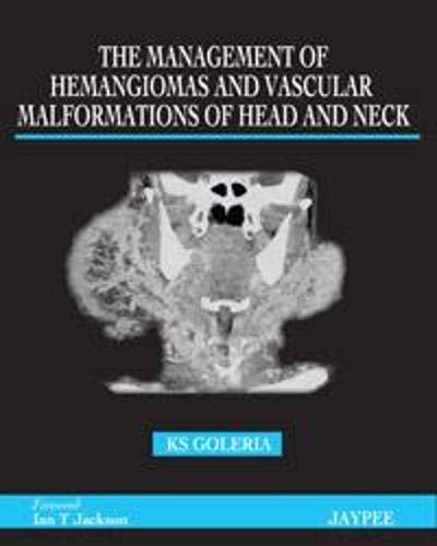 the-management-of-hemangiomas-and-vascular-malformations-of-head-and-neck