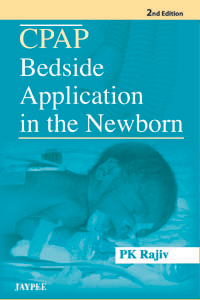 cpap-bedside-application-in-the-newborn