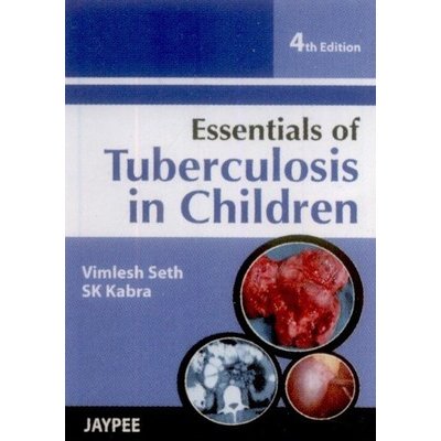 essentials-of-tuberculosis-in-children