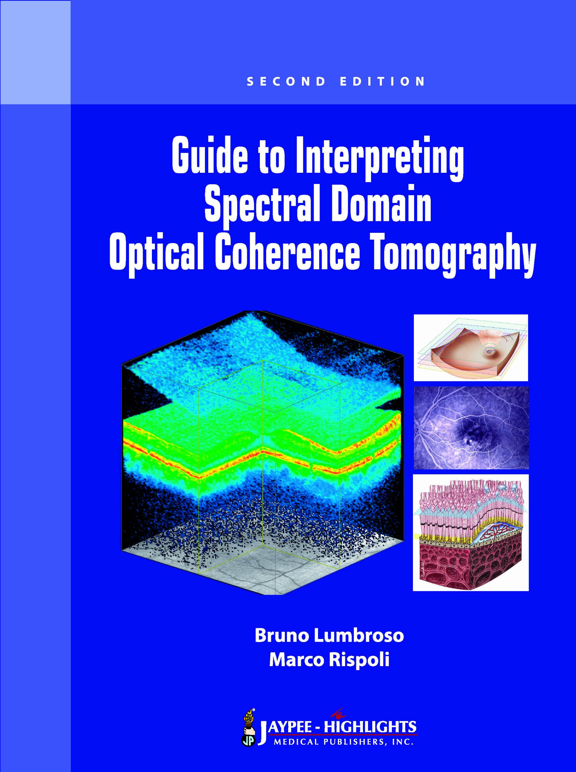 guide-to-interpreting-spectral-domain-optical-coherence-tomography