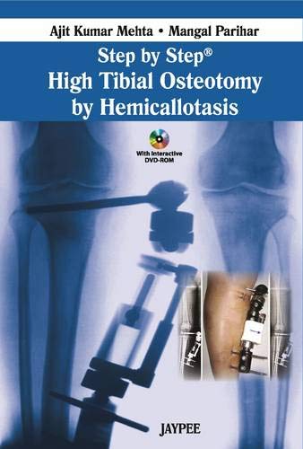 step-by-step-high-tibial-osteotomy-by-hemicallotasis-with-dvd-rom