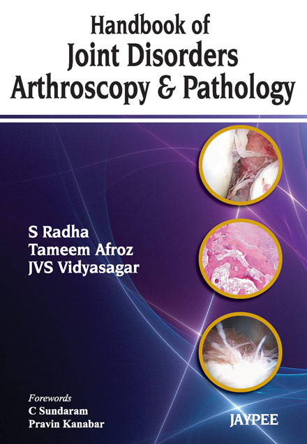 handbook-of-joint-disorders-arthroscopy-pathology