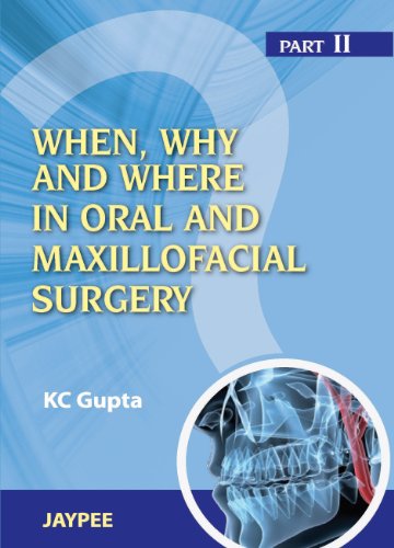 whenwhy-and-where-in-oral-and-maxillofacial-surgery-part-ii