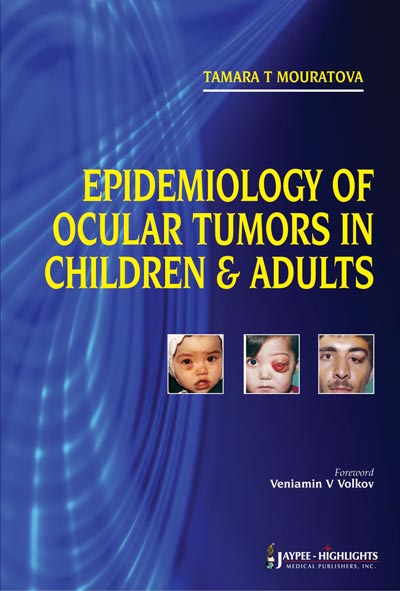 epidemiology-of-ocular-tumors-in-children-adults