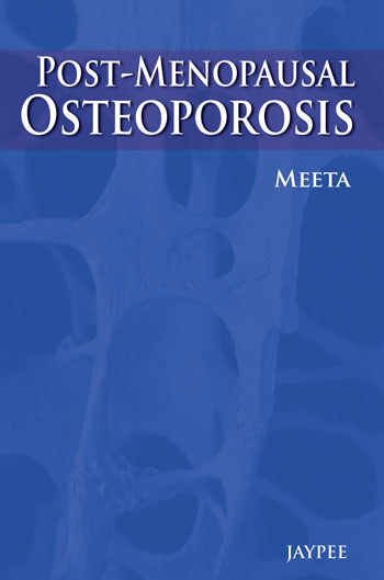 postmenopausal-osteoporosis-basic-clinical-concepts