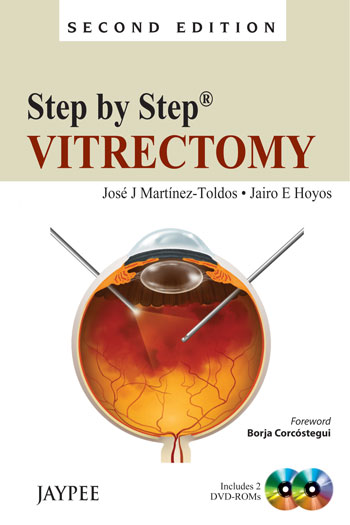 drhoyosstep-by-step-vitrectomy-inc2-dvd-roms