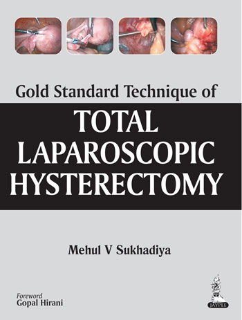 gold-standard-technique-of-total-laparoscopic-hysterectomy