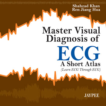 master-visual-diagnosis-of-ecg-a-short-atlas-learn-ecg-through-ecg