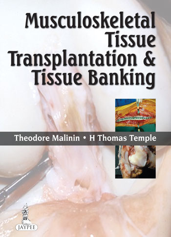 musculoskeletal-tissue-transplantation-and-tissue-banking