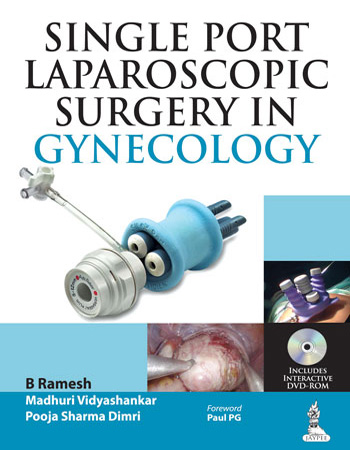 single-port-laparoscopic-surgery-in-gynecology-includes-dvd-rom