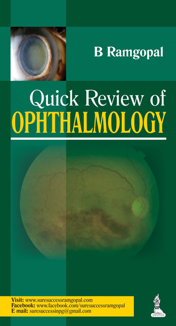 quick-review-of-ophthalmology