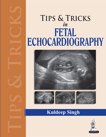 tips-trics-in-fetal-echocardiography