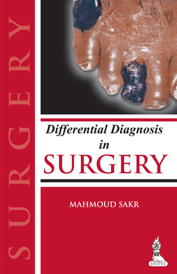 differential-diagnosis-in-surgery