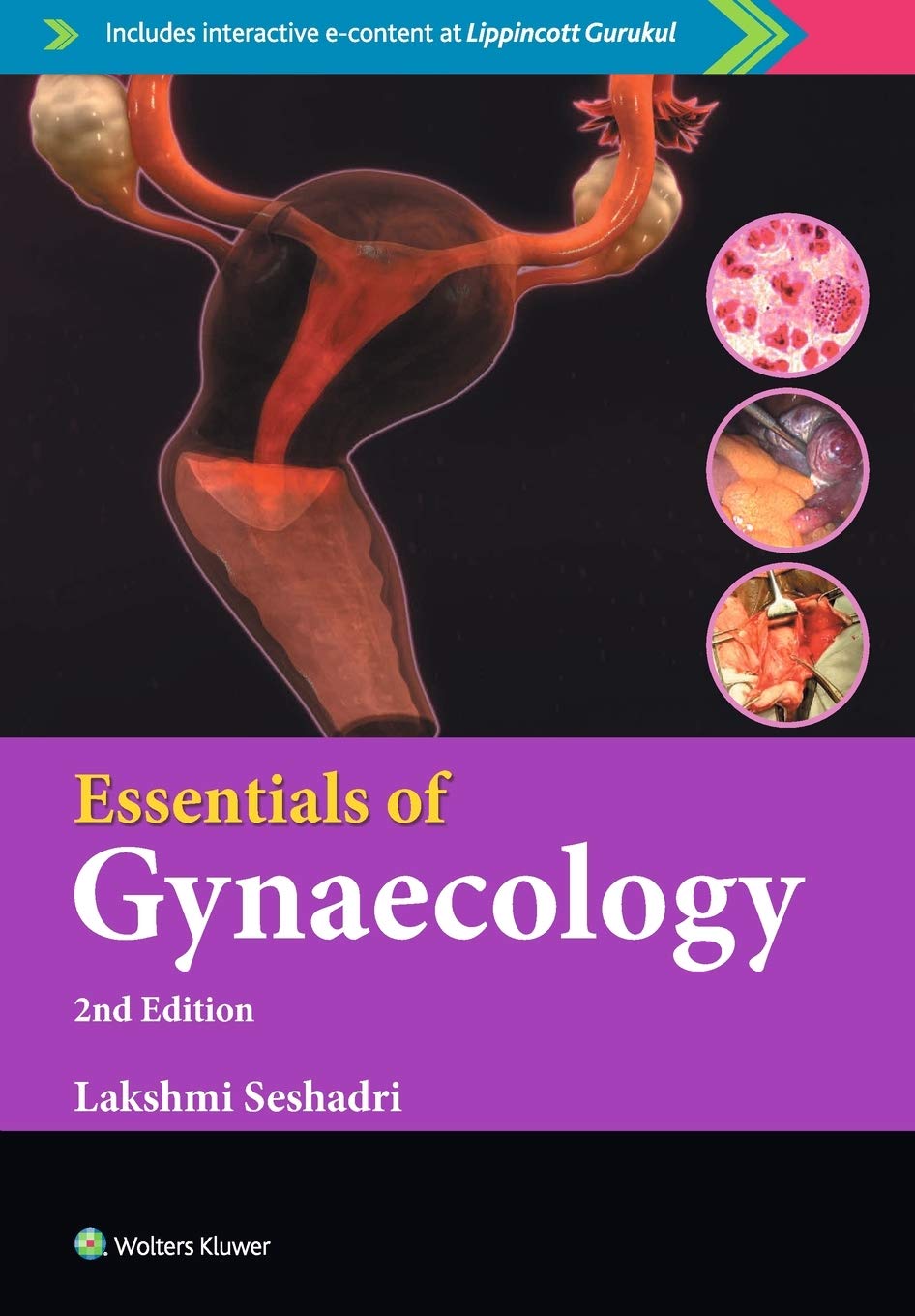 essentials-of-gynaecology-2e