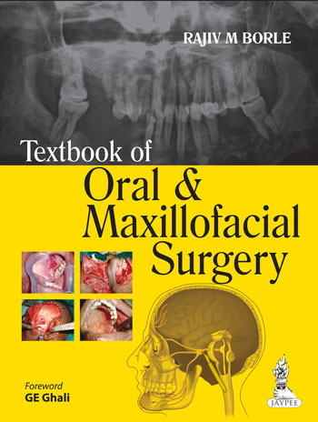 textbook-of-oral-maxillofacial-surgery