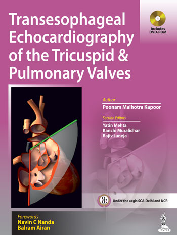 transesophageal-echocardiography-of-the-tricuspid-pulmonary-valves-includes-dvd-rom