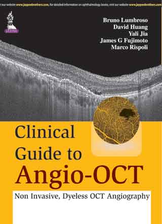 clinical-guide-to-angio-oct-non-invasivedyeless-oct-angiography