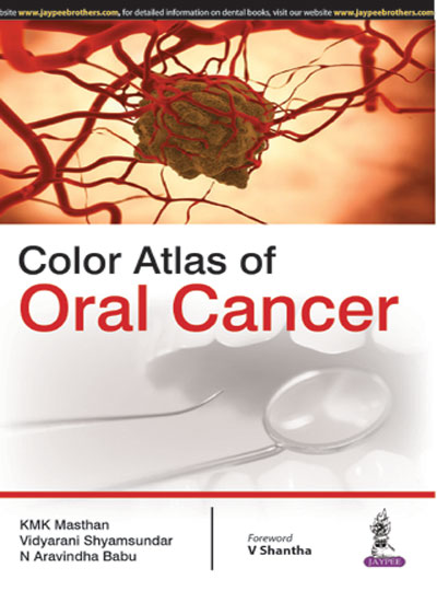 color-atlas-of-oral-cancer