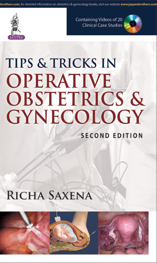 tips-tricks-in-operative-obstetrics-gynecology-with-dvd-rom