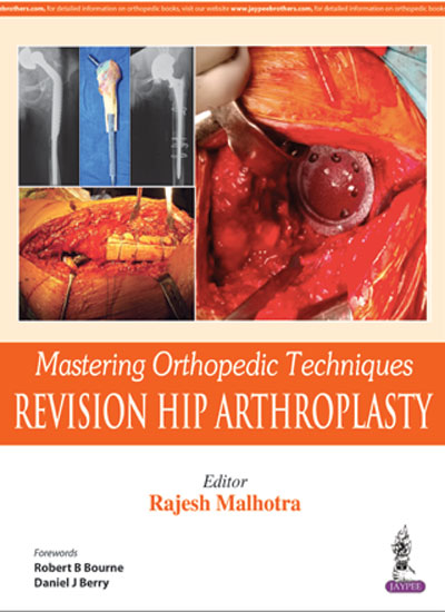 mastering-orthopedic-techniques-revision-hip-arthroplasty