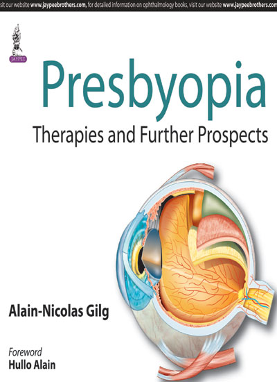 presbyopiatherapies-and-further-prospects