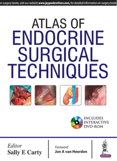 atlas-of-endocrine-surgical-techniques-with-dvd-rom