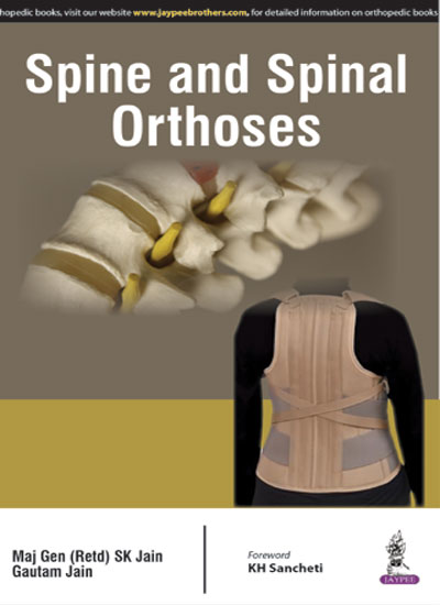 spine-and-spinal-orthoses