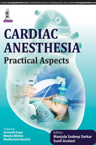 cardiac-anesthesiapractical-aspects