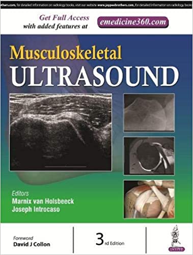 musculoskeletal-ultrasound