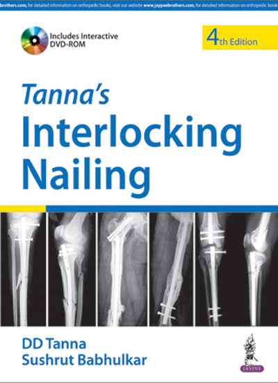 tannas-interlocking-nailing-with-dvd-rom