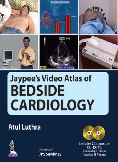 jaypees-video-atlas-of-bedside-cardiology-includes-2-interactive-cd-roms